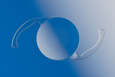 ReStor IOL Burbank AcrySof ReStor IOL Example