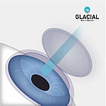 Bladeless LASIK Diagram 3